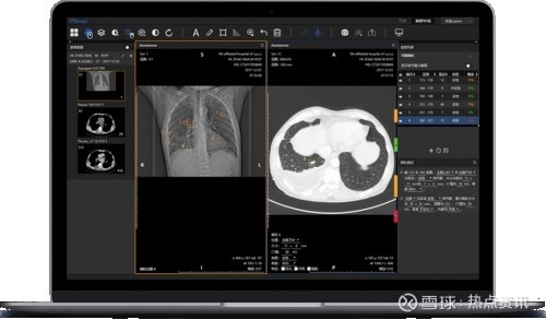 医学影像软件有哪些_医学影像学软件_影像医学软件有哪些