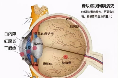 复视症游戏,复视症游戏中的视觉挑战之旅